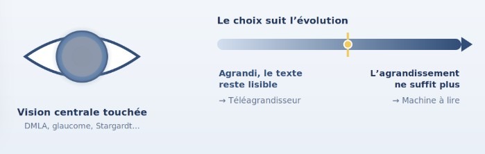 Le choix d'une machine à lire dépend du stade de la maladie, pas du diagnostic : tant que le texte agrandi reste lisible, un téléagrandisseur convient ; quand l'agrandissement ne suffit plus, une machine à lire s'impose.